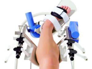 Artromot SP3 standard - Motodlaha na kotník - Image 6